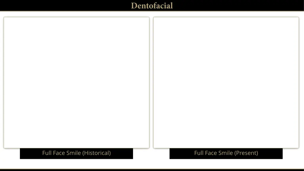 full face smile historical