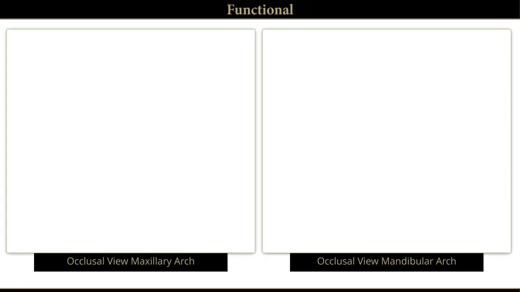 occlusal view maxillary arch 1