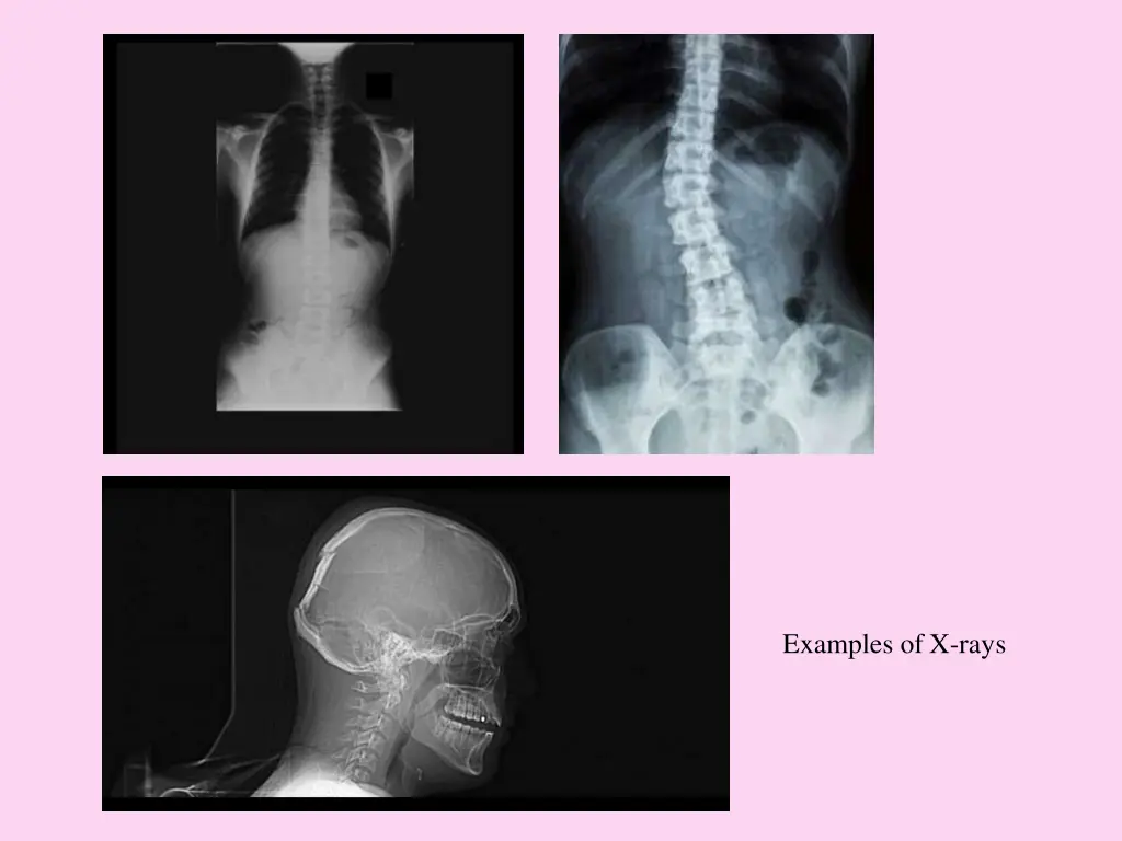 examples of x rays