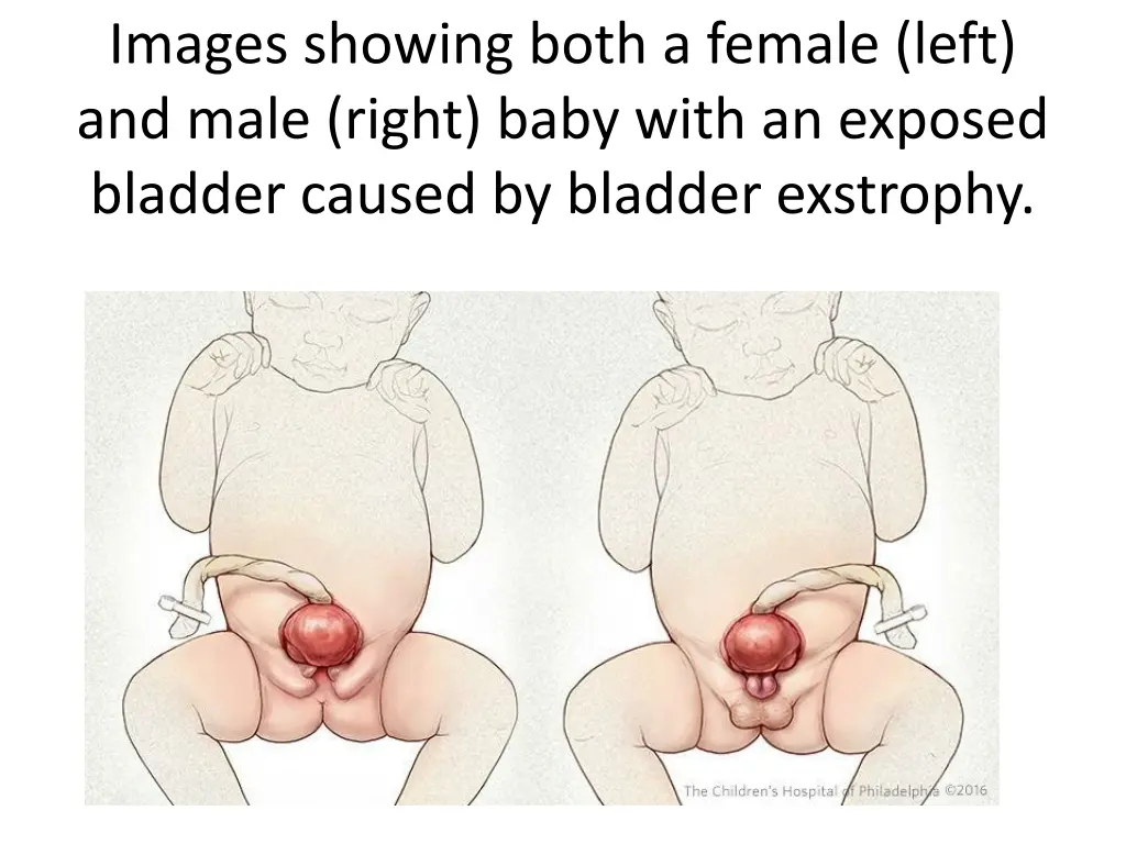 images showing both a female left and male right