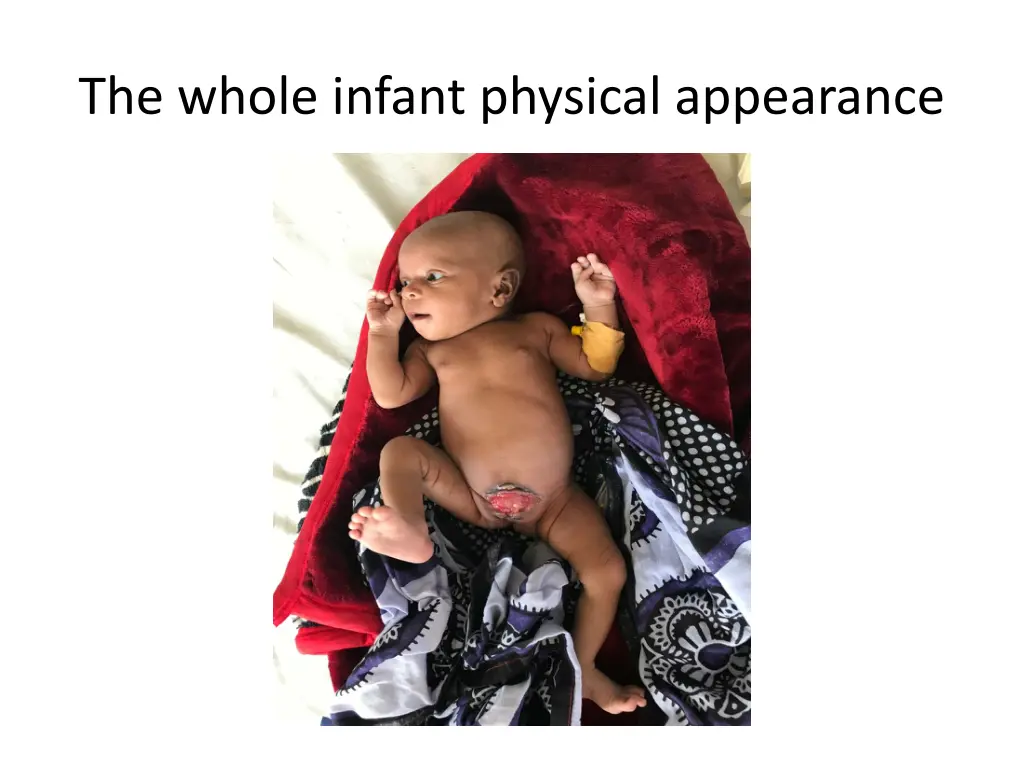 the whole infant physical appearance