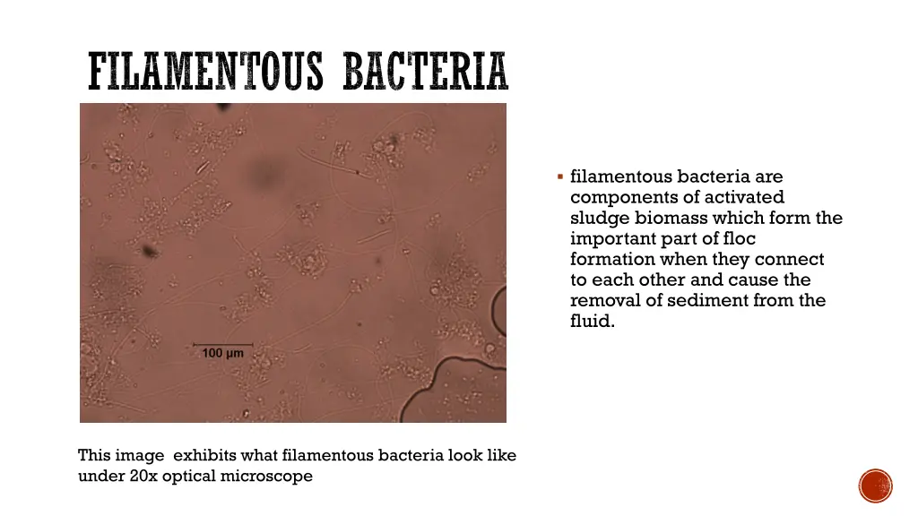 filamentous bacteria