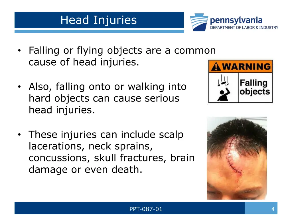 head injuries