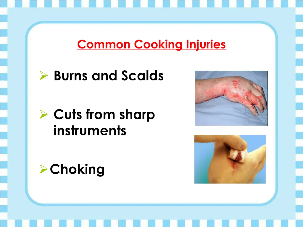 common cooking injuries