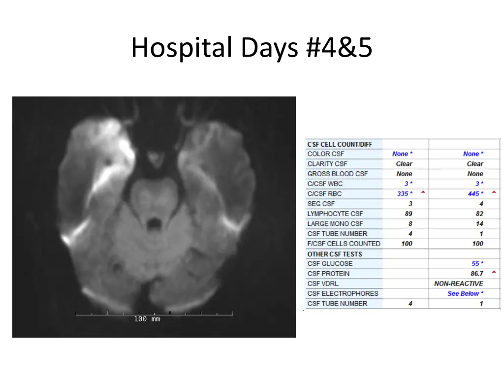 hospital days 4 5