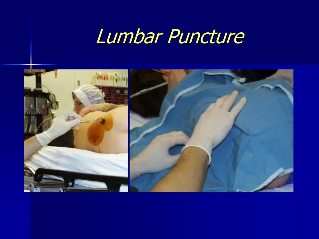 lumbar puncture 6