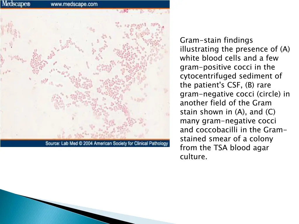 gram stain findings illustrating the presence