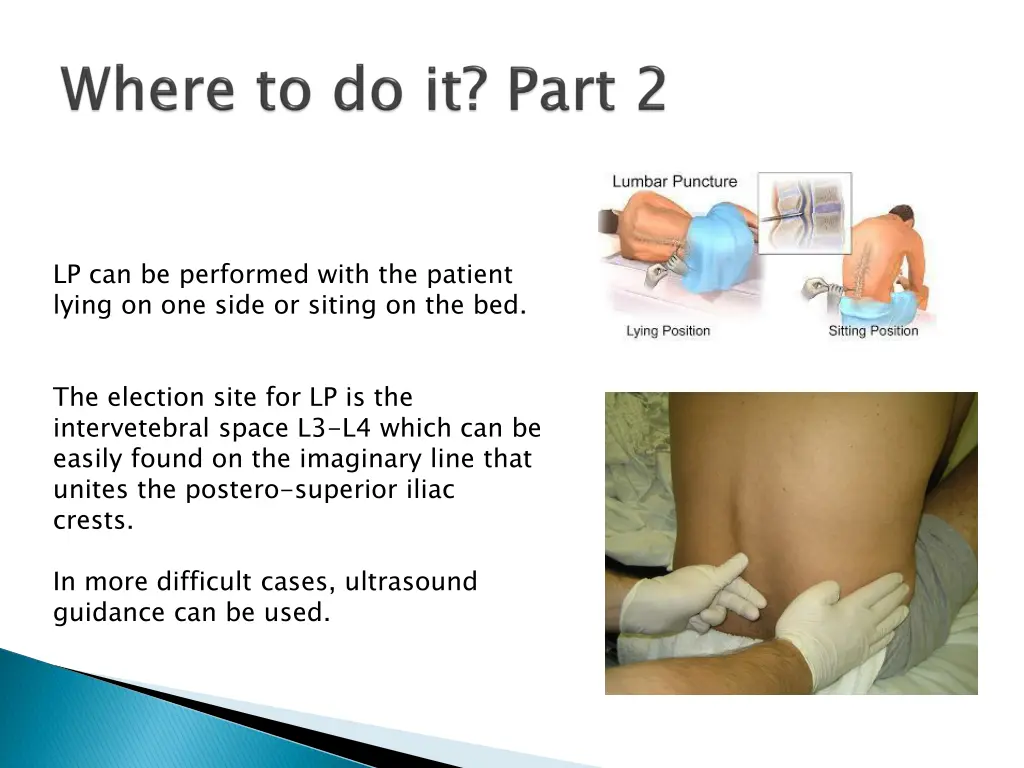 lp can be performed with the patient lying