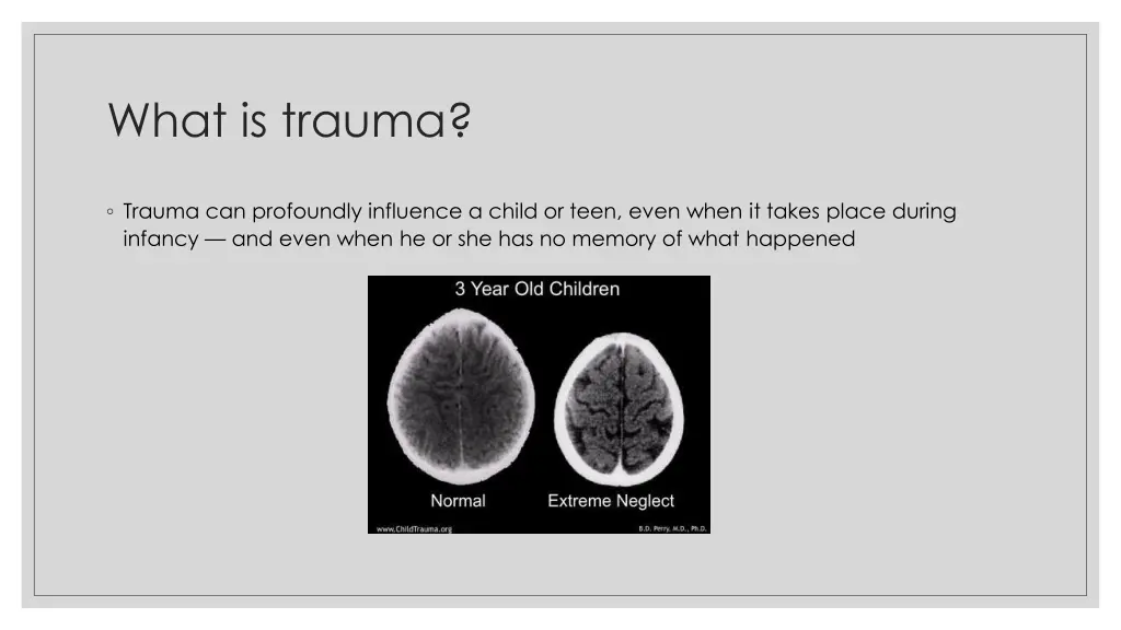 what is trauma 1