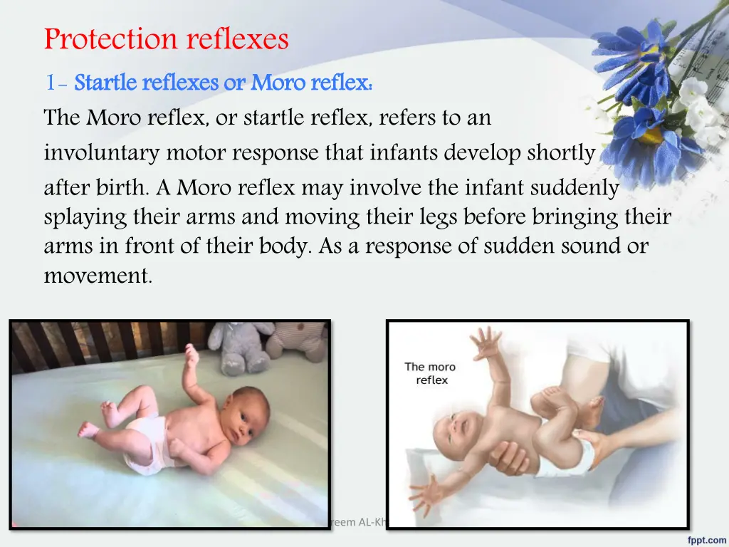 protection reflexes 1 startle the moro reflex