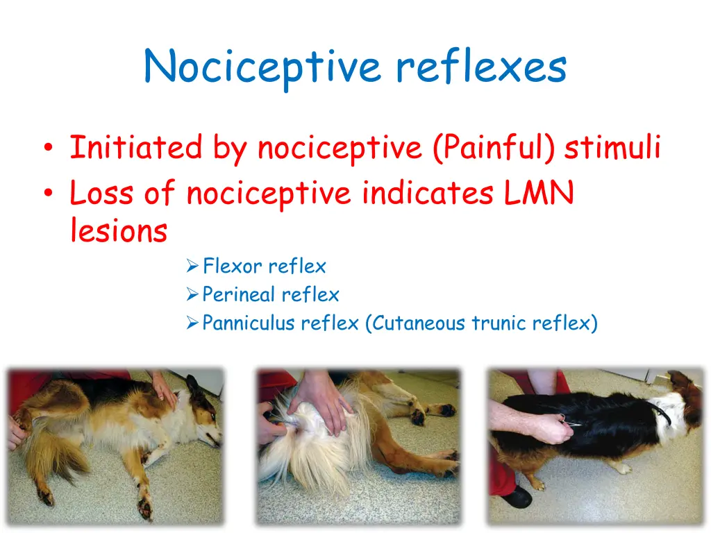 nociceptive reflexes