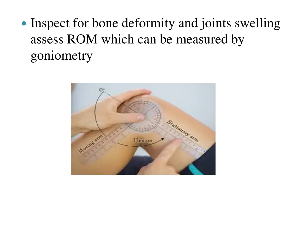 inspect for bone deformity and joints swelling