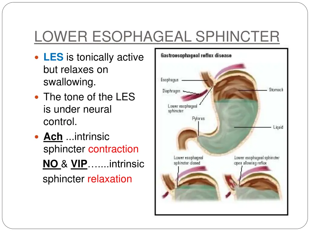 lower esophageal sphincter