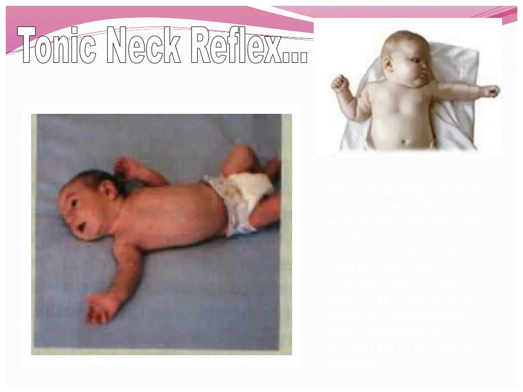 tonic neck reflex