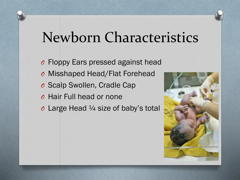 newborn characteristics