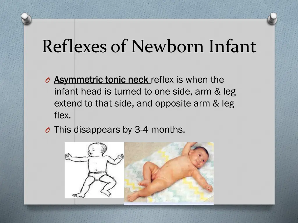 reflexes of newborn infant 4