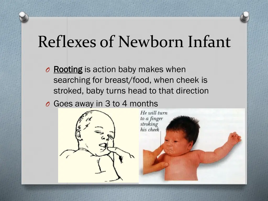 reflexes of newborn infant