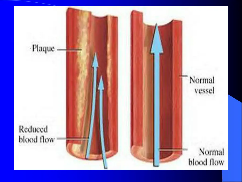 slide15