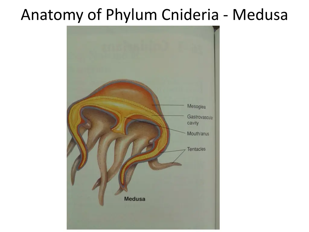 anatomy of phylum cnideria medusa