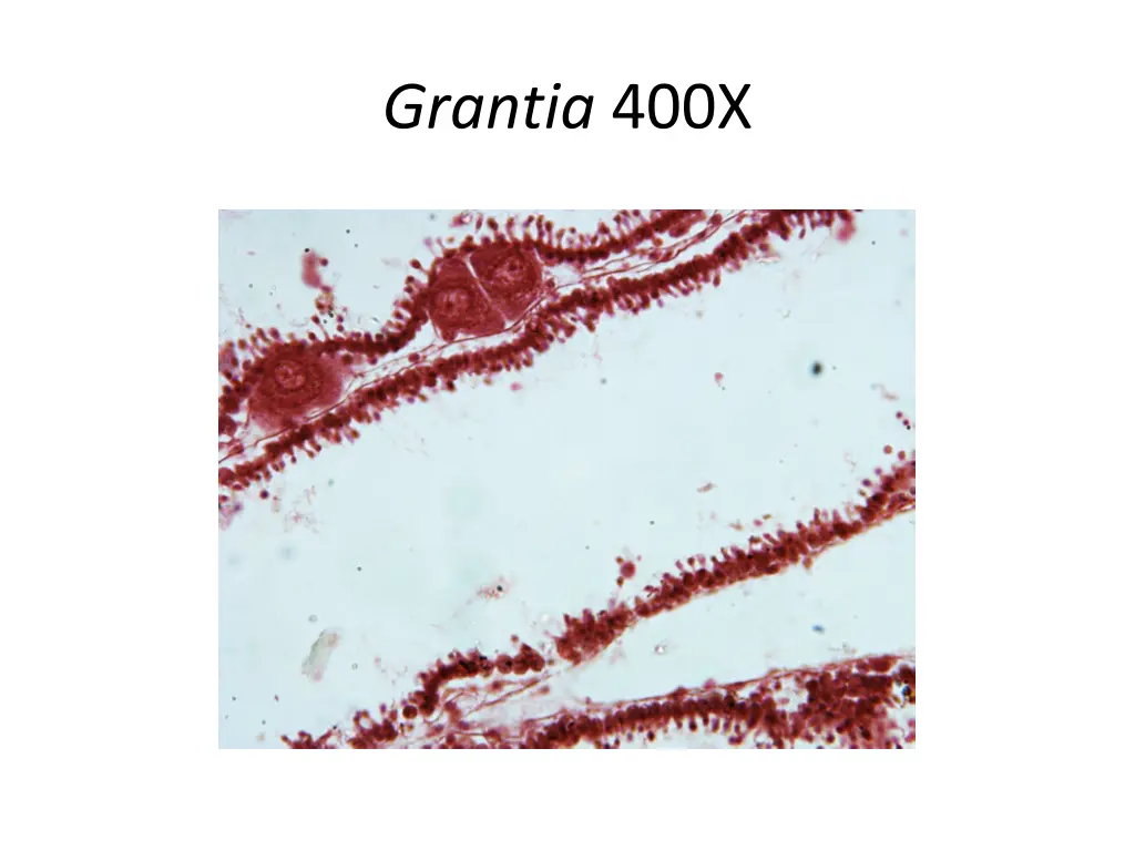 grantia 400x