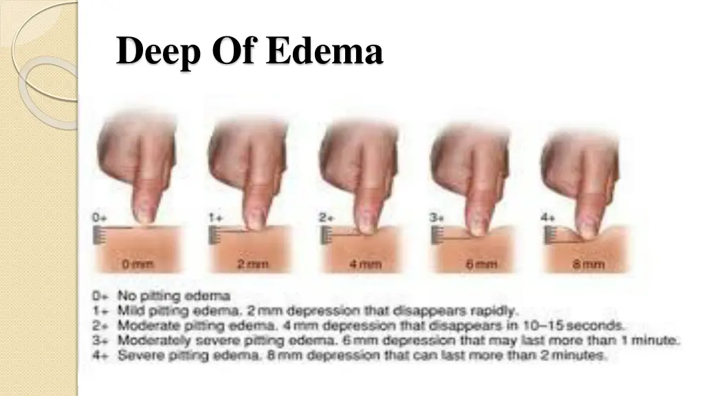 deep of edema