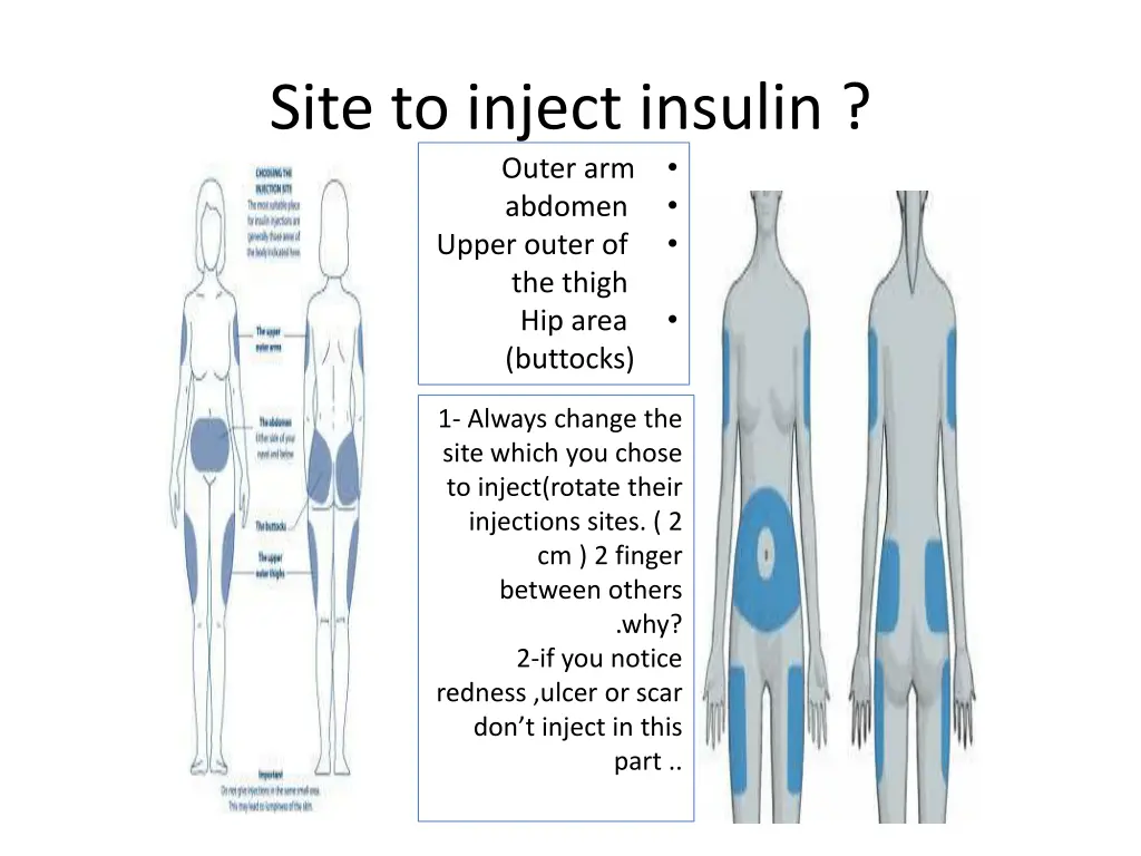 site to inject insulin outer arm abdomen upper