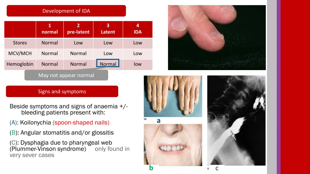 development of ida