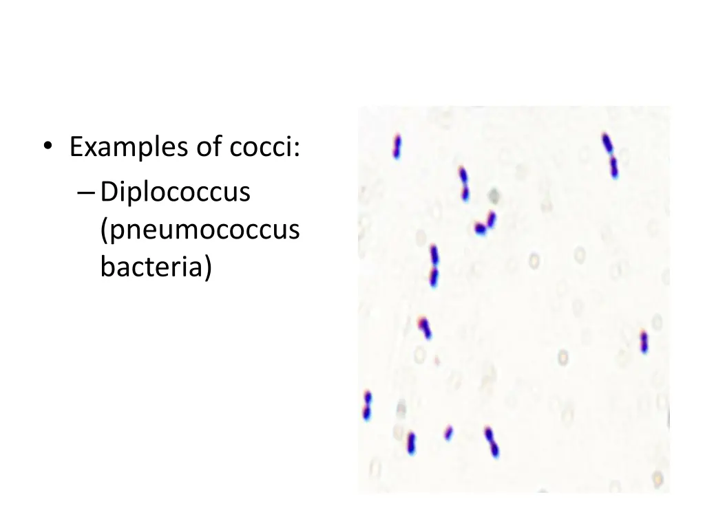 examples of cocci diplococcus pneumococcus