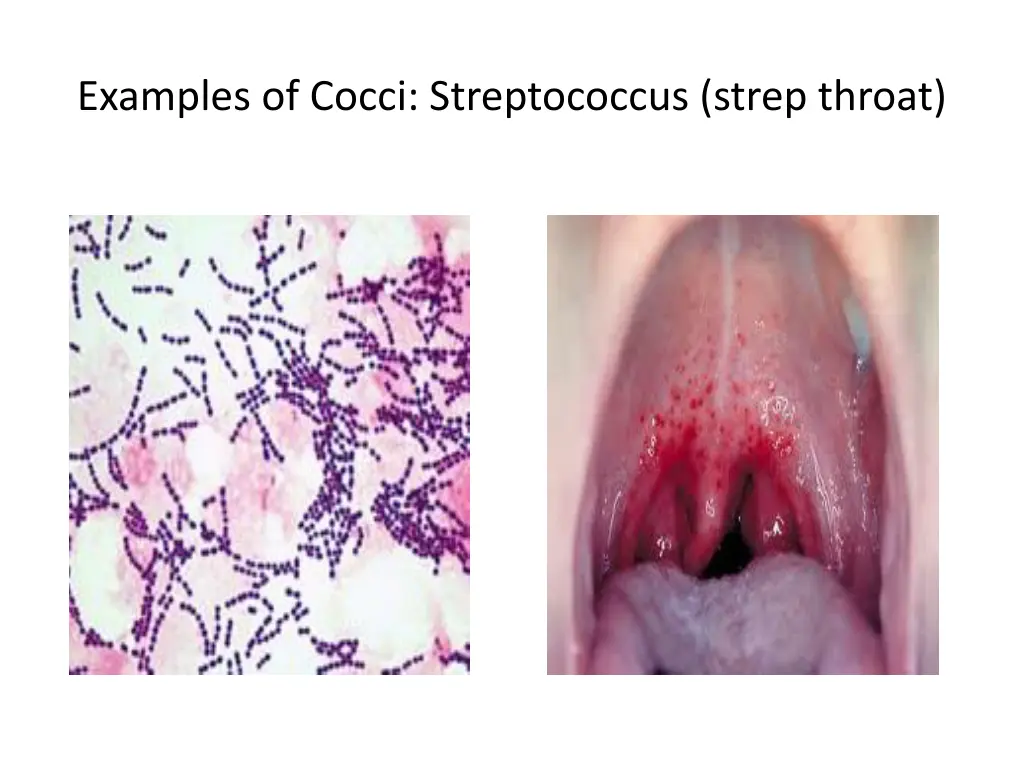 examples of cocci streptococcus strep throat