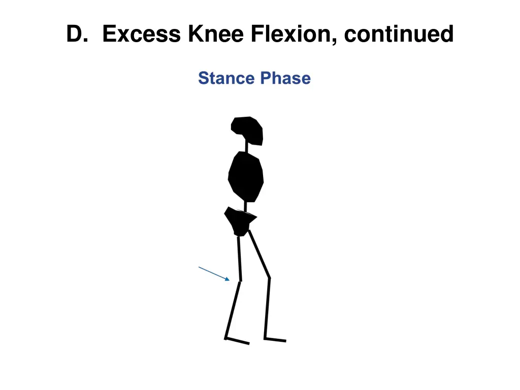 d excess knee flexion continued