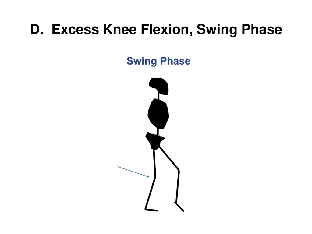 d excess knee flexion swing phase