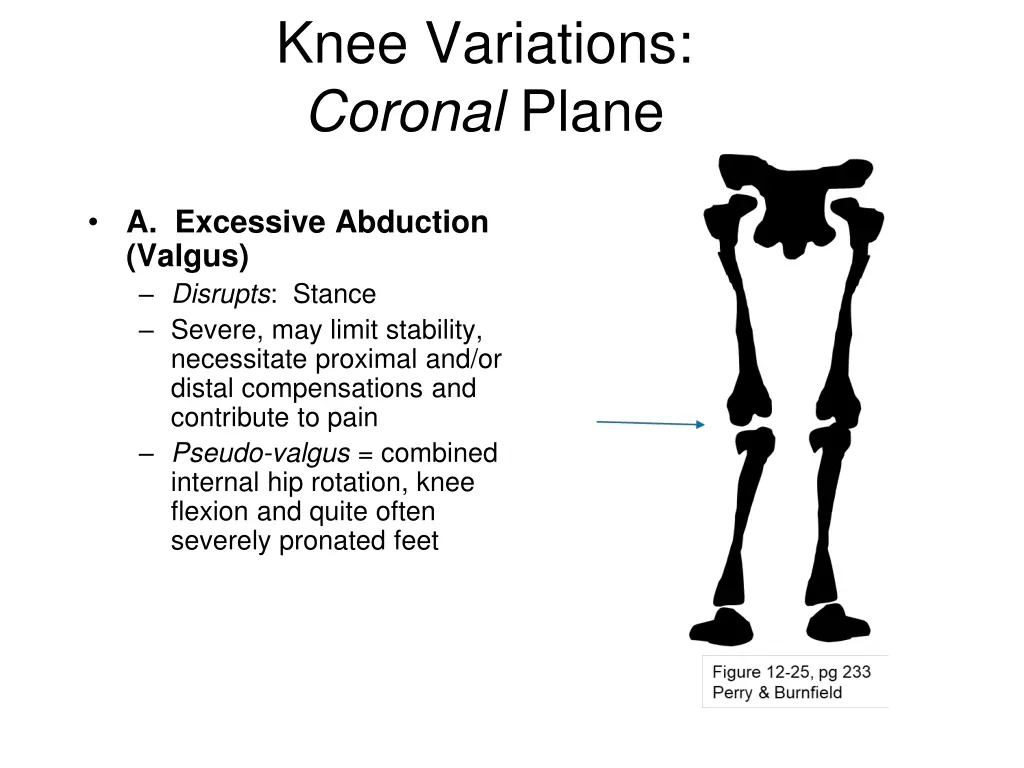 knee variations coronal plane