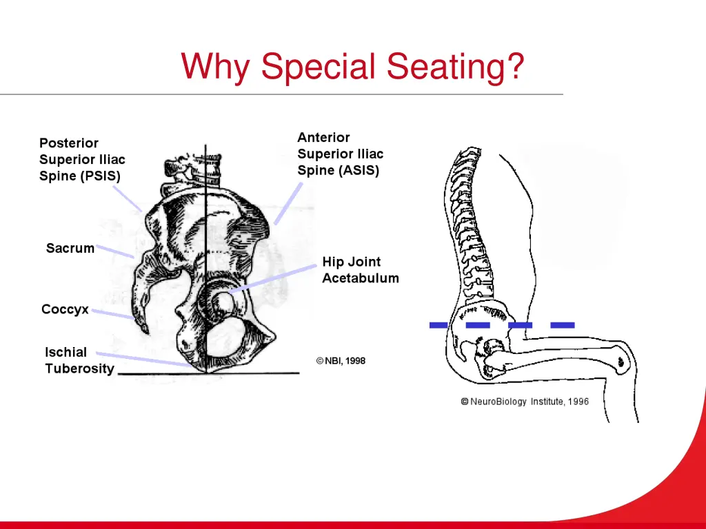 why special seating 1