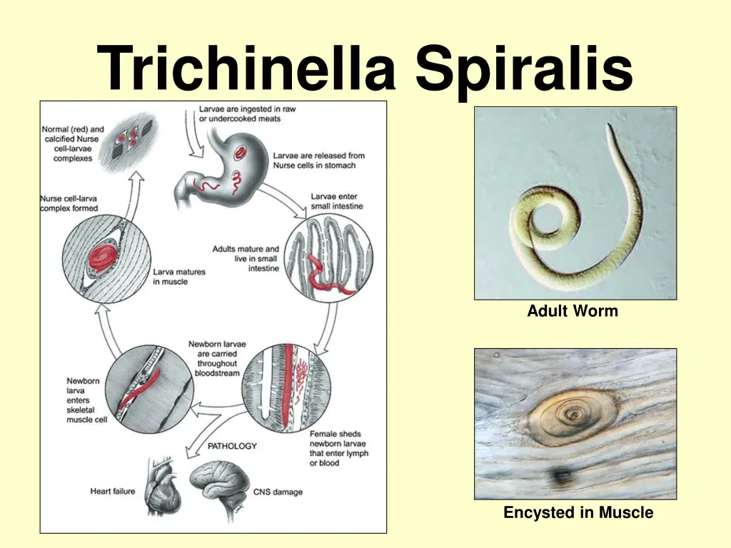 figure 3 trichinella spiralis