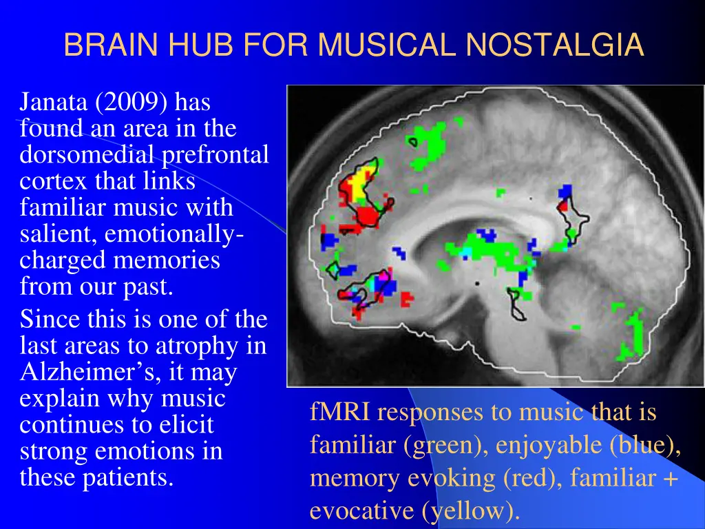 brain hub for musical nostalgia