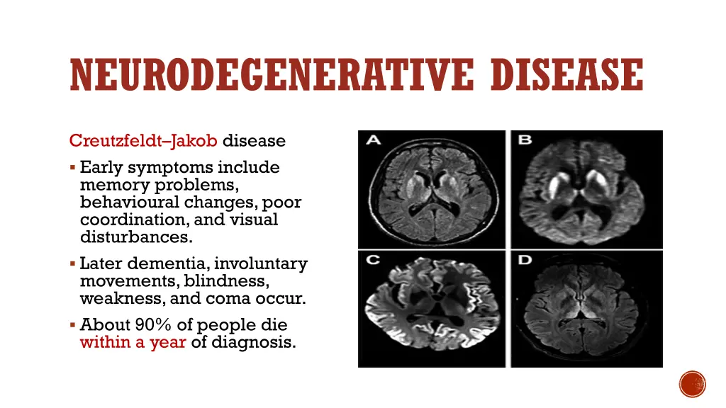 neurodegenerative disease