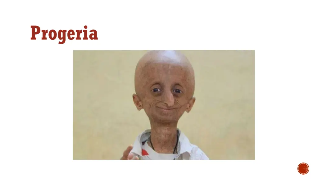 progeria