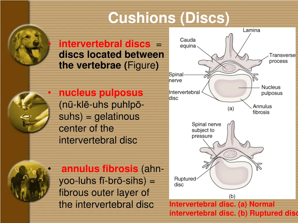 cushions discs