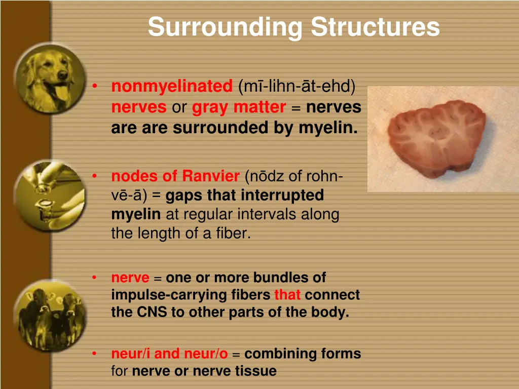 surrounding structures 1