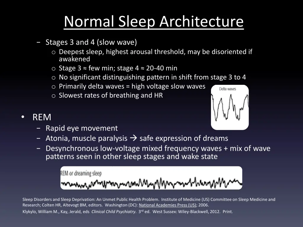 normal sleep architecture 1