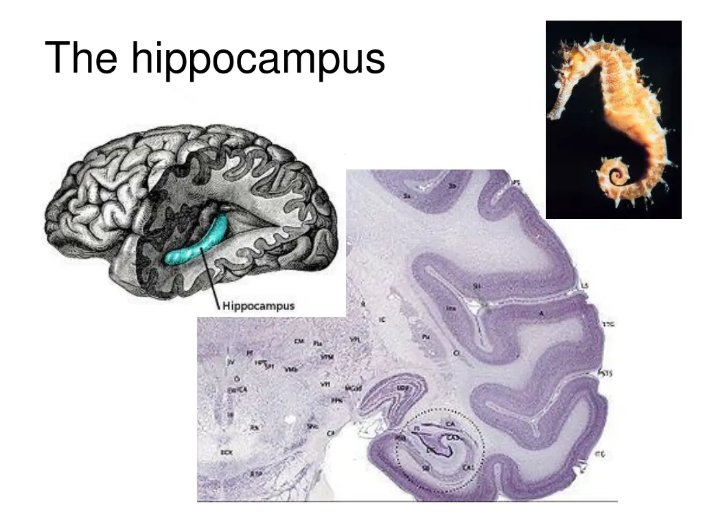 the hippocampus