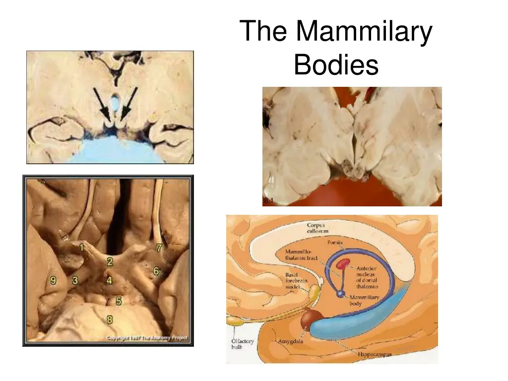 the mammilary bodies