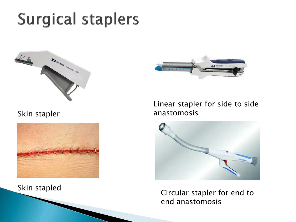 linear stapler for side to side anastomosis