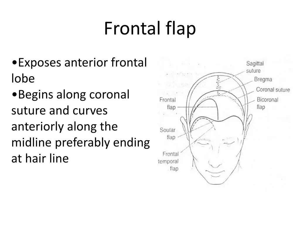 frontal flap