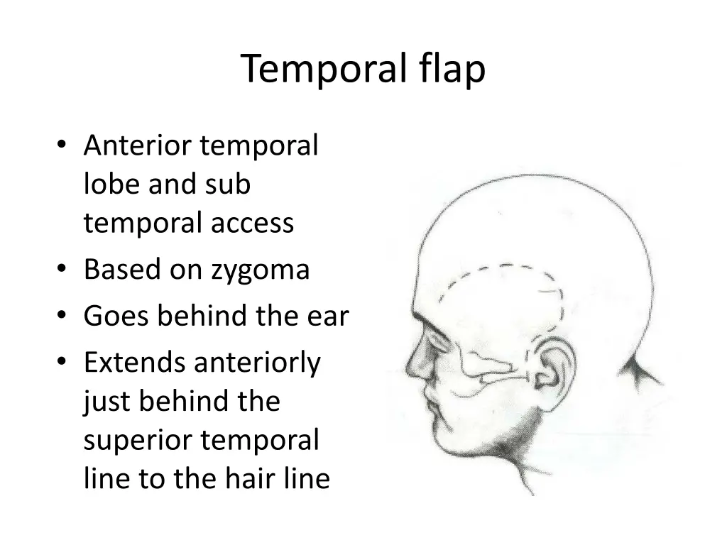 temporal flap