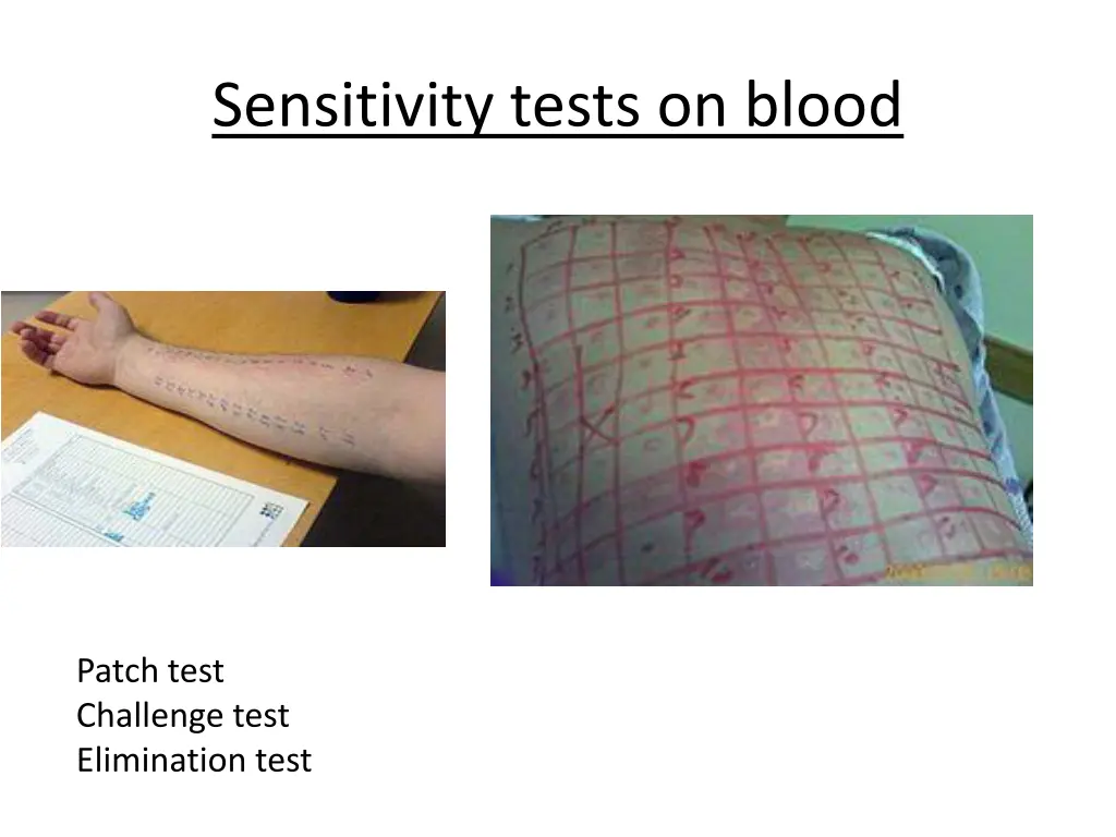 sensitivity tests on blood