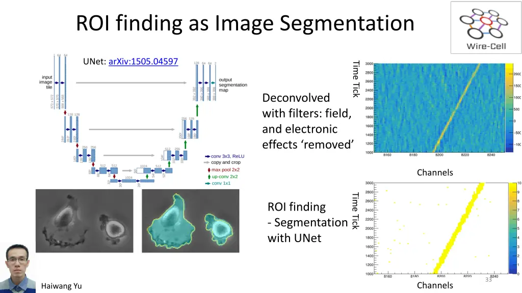 roi finding as image segmentation