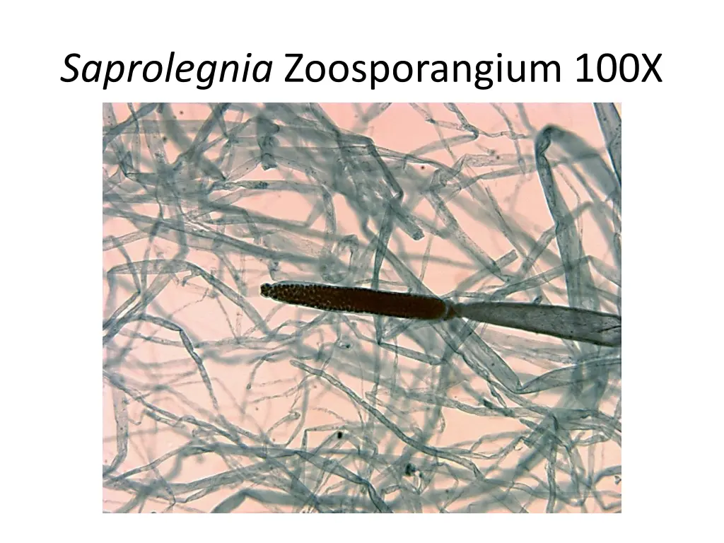 saprolegnia zoosporangium 100x