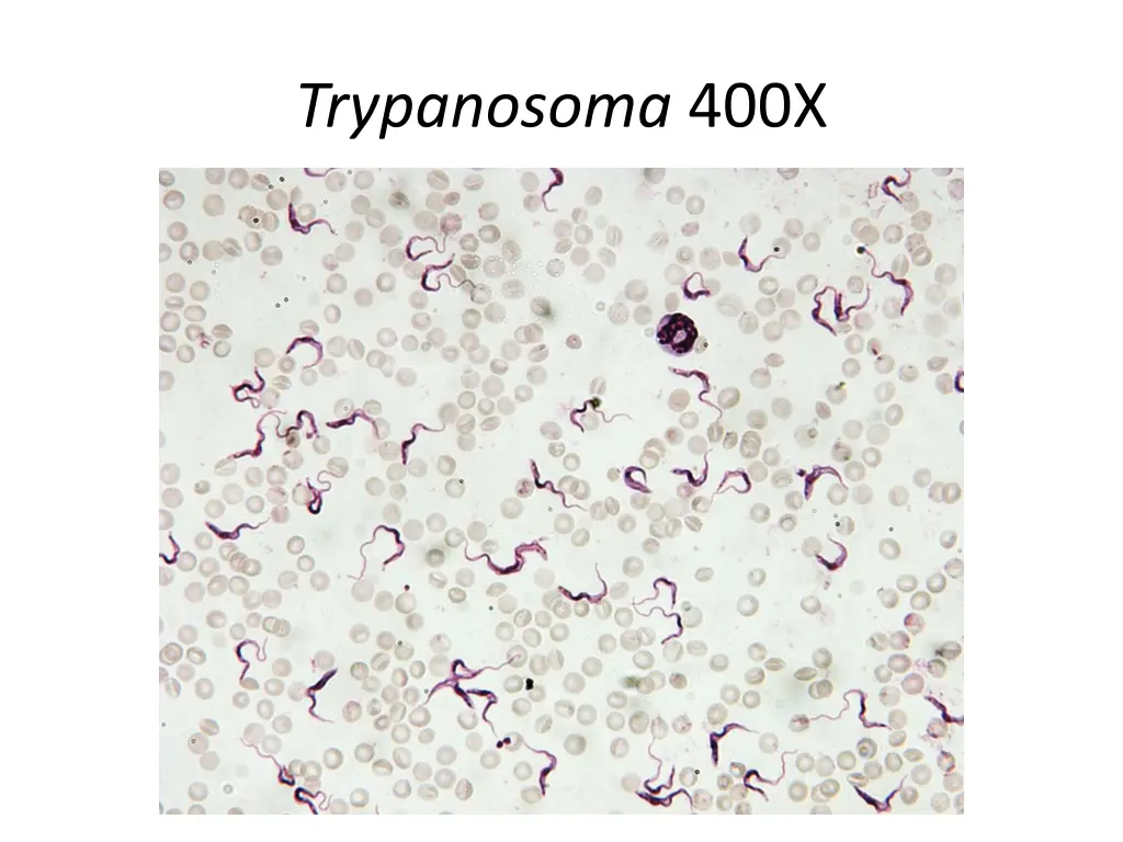 trypanosoma 400x