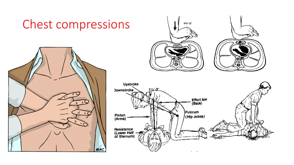 chest compressions 2